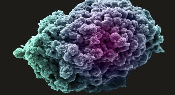 Cancer Cell